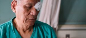 Katarakt Ameliyatı Sonrası Süreç