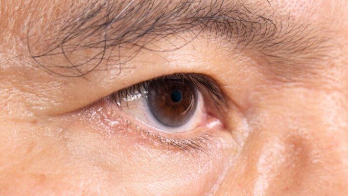 Retina Dekolmani Ameliyati Olanlarin Yorumlari Retina Dekolmanı Ameliyatı Olanların Yorumları