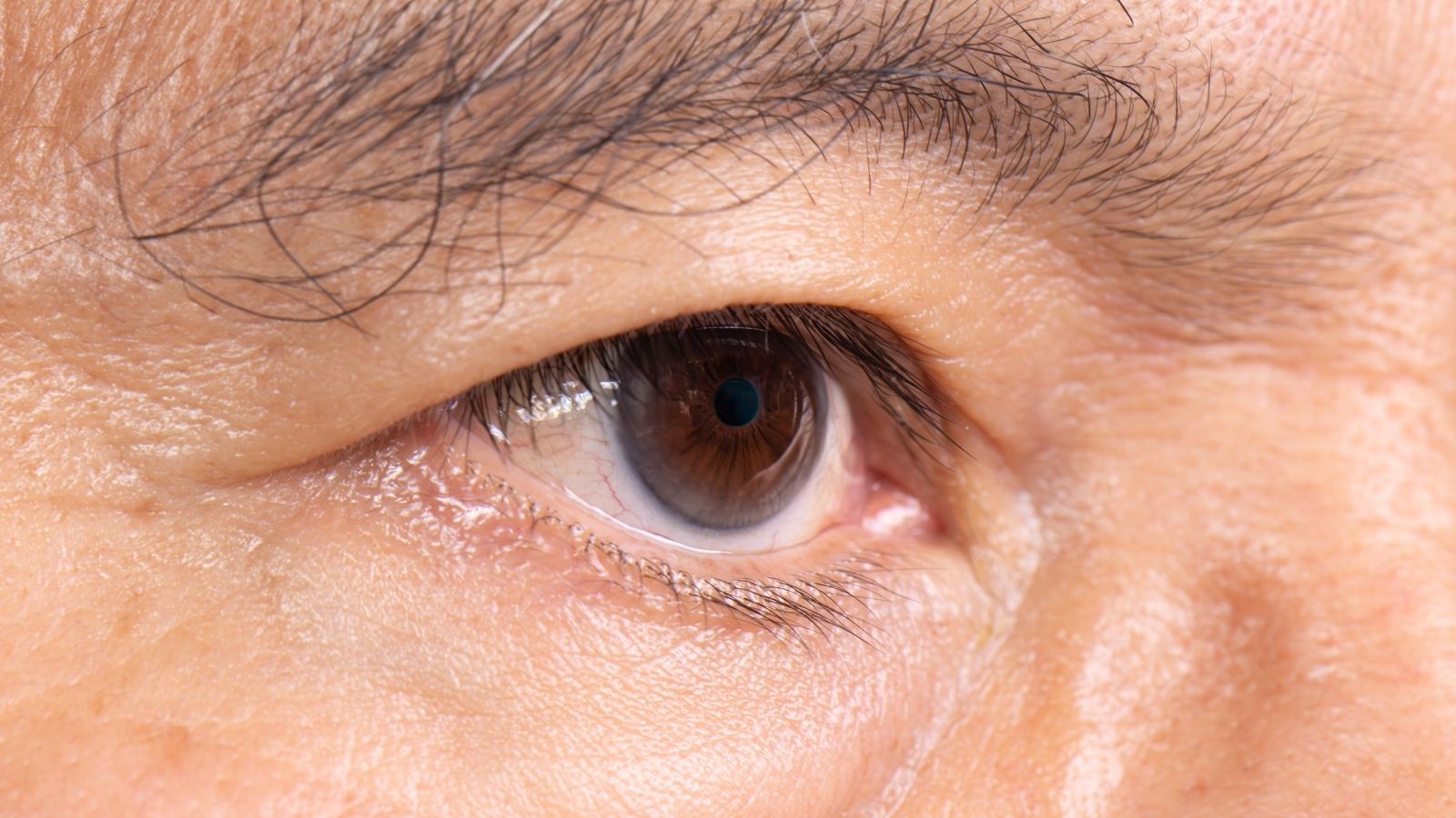 Retina Dekolmani Ameliyati Olanlarin Yorumlari Retina Dekolmanı Ameliyatı Olanların Yorumları