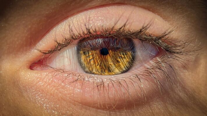 Akilli Lens Ameliyati Sonrasi Sikayetler Nedenleri ve Cozumleri Akıllı Lens Ameliyatı Sonrası Şikayetler: Nedenleri ve Çözümleri