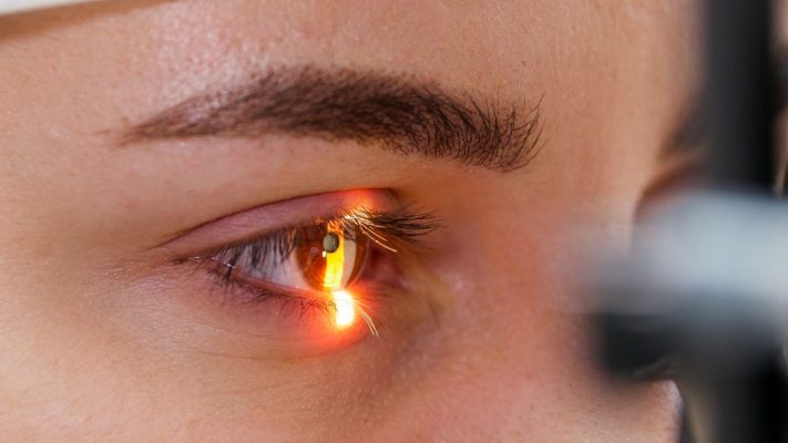 Retina Yirtigi Tedavisi Lazerle Retina Yırtığı Tedavisi (Lazerle)